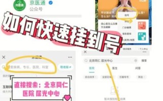 北京同仁眼科医院怎么挂号_北京同仁眼科医院专家号预约攻略