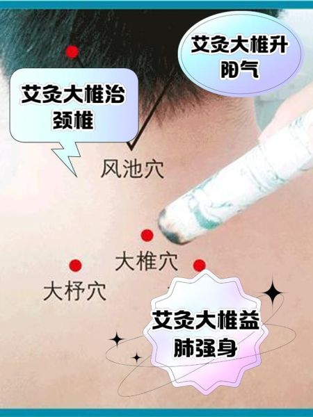 艾灸多久做一次合适_艾灸能天天做吗-第2张图片-俊逸知识馆