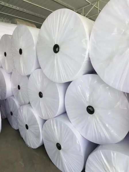 无纺布多少钱一吨_无纺布生产厂家哪家好-第2张图片-俊逸知识馆 无纺布多少钱一吨_无纺布生产厂家哪家好-第2张图片-俊逸知识馆