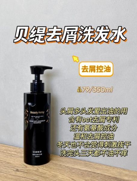 什么洗发水适合油性头皮_控油洗发水哪个牌子好-第2张图片-俊逸知识馆 什么洗发水适合油性头皮_控油洗发水哪个牌子好-第2张图片-俊逸知识馆