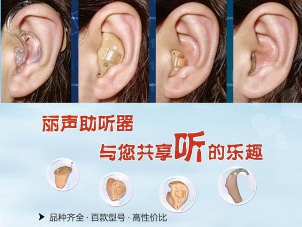 丽声怎么样_丽声助听器效果好吗-第1张图片-俊逸知识馆