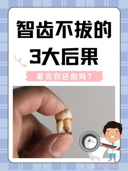 不拔智齿会怎么样_智齿不拔有什么后果-第1张图片-俊逸知识馆