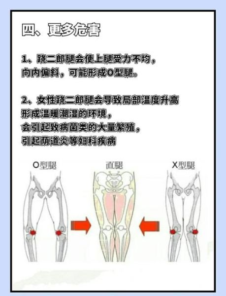 翘二郎腿会怎么样_长期翘二郎腿的危害-第2张图片-俊逸知识馆
