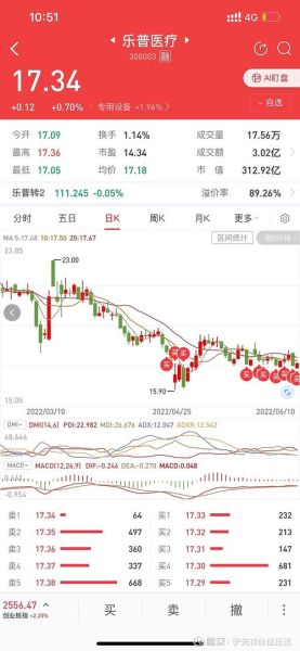 乐普医疗股票值得长期持有吗_乐普医疗未来股价走势分析-第1张图片-俊逸知识馆 乐普医疗股票值得长期持有吗_乐普医疗未来股价走势分析-第1张图片-俊逸知识馆