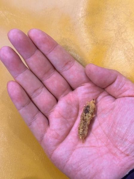 吃了耳屎会怎么样_耳屎有毒吗-第3张图片-俊逸知识馆