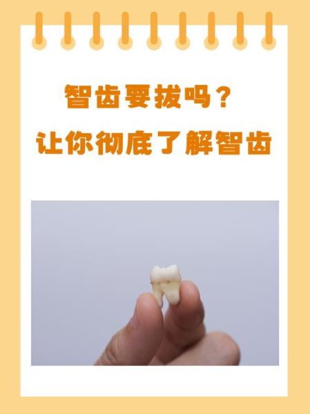 智齿怎么样才能拔_拔智齿前需要准备什么-第2张图片-俊逸知识馆